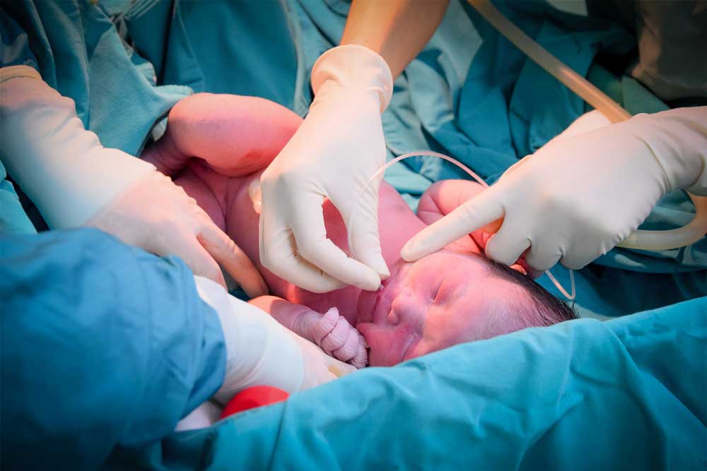 جراحی نوزاد