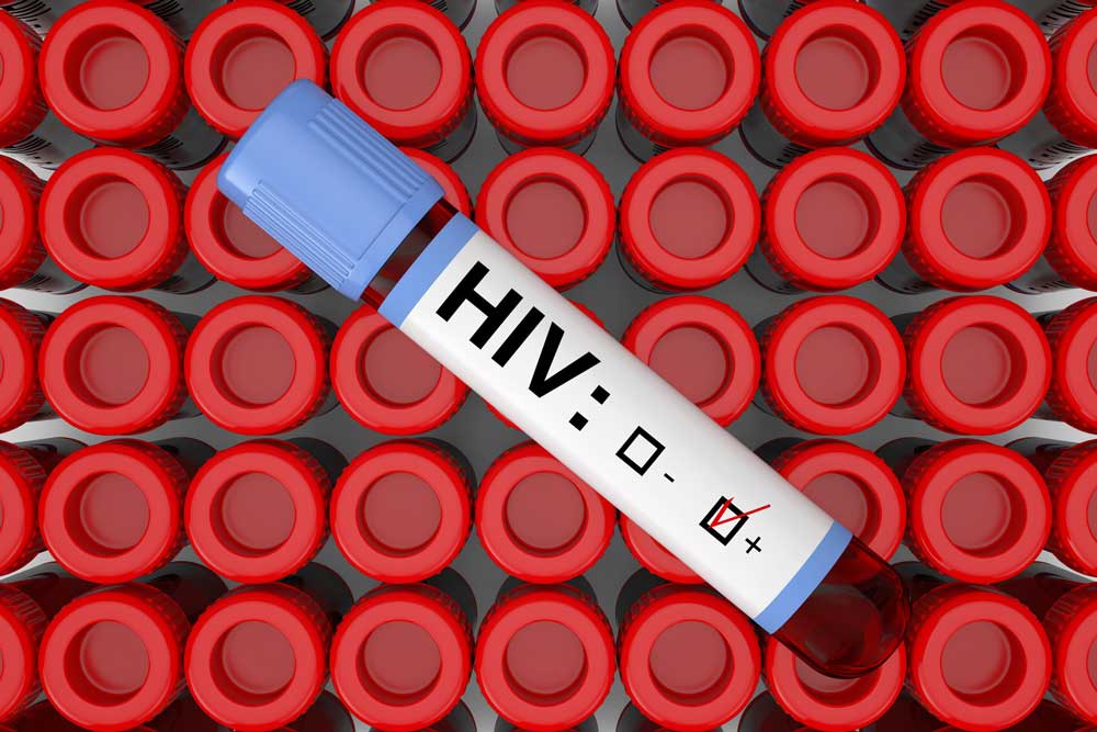 HIV اچ آی وی